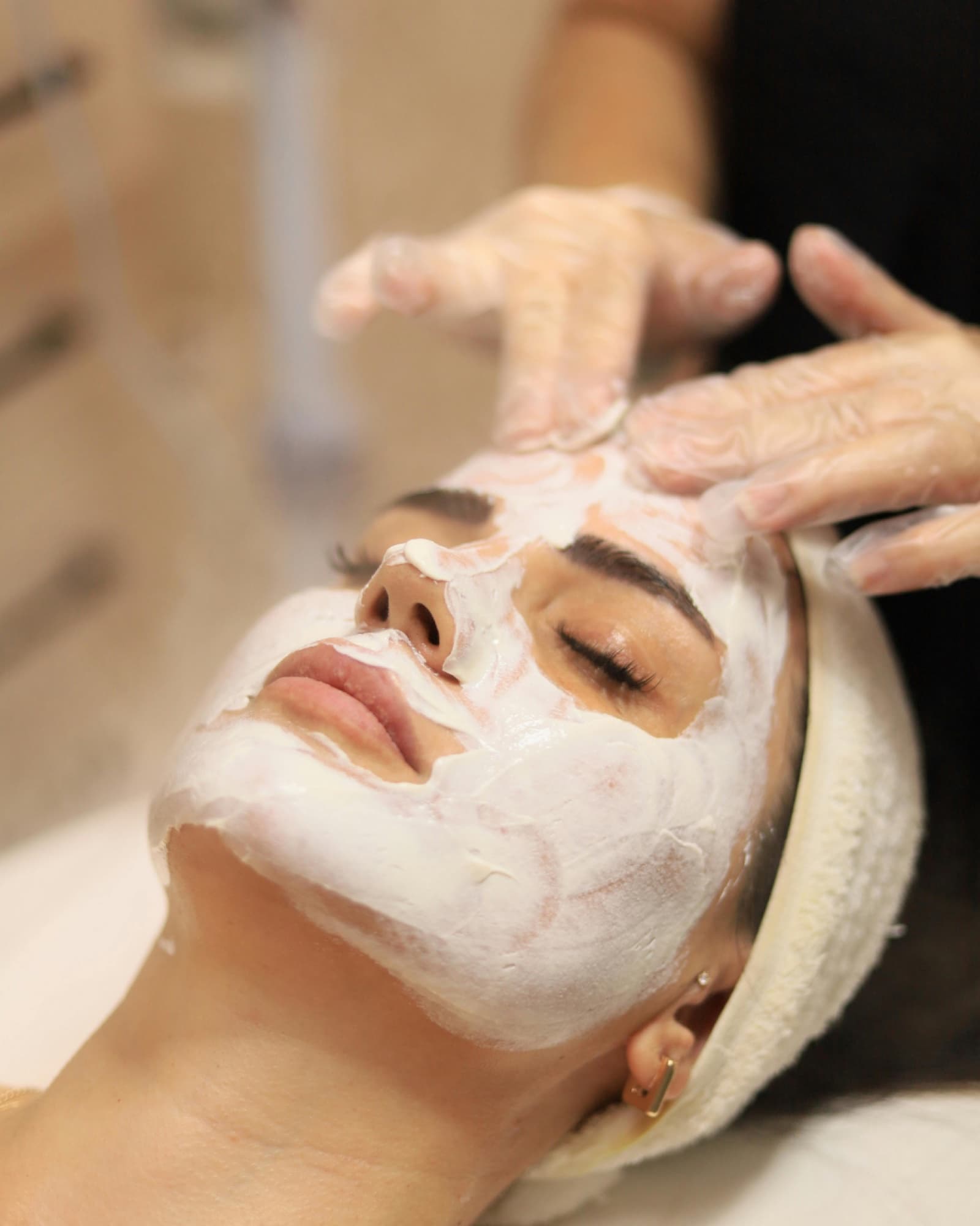 Protocolo facial para piel con tendencia acneica en el centro de Irene Ortiz
